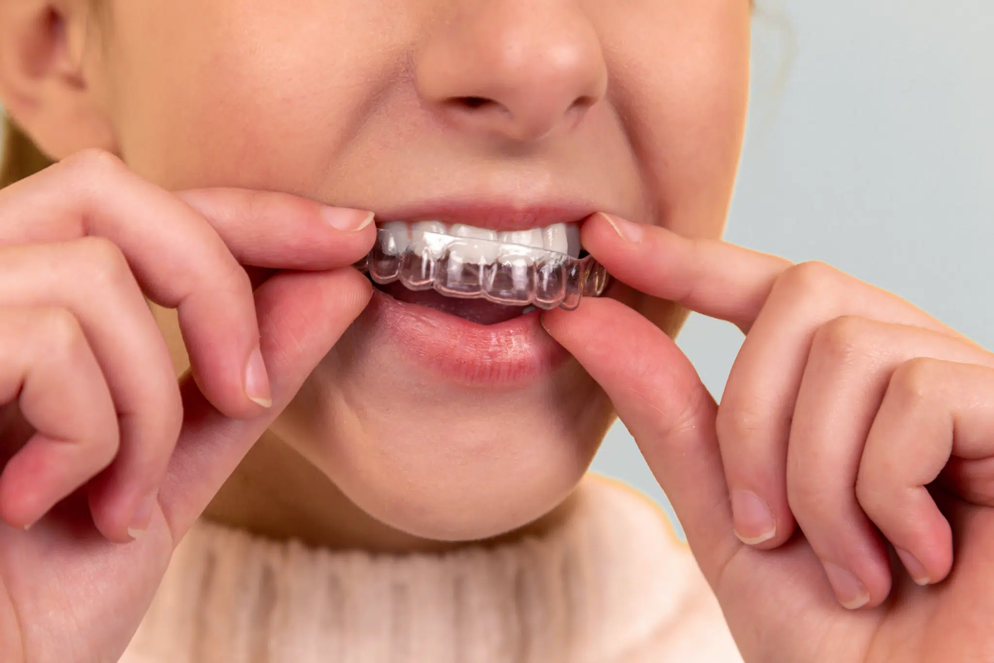 The Importance of Wearing Your Retainer After Orthodontic Treatment