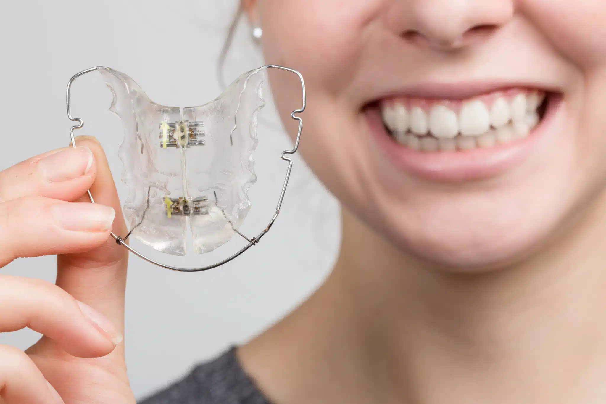 How Long Do I Need to Wear My Retainer?