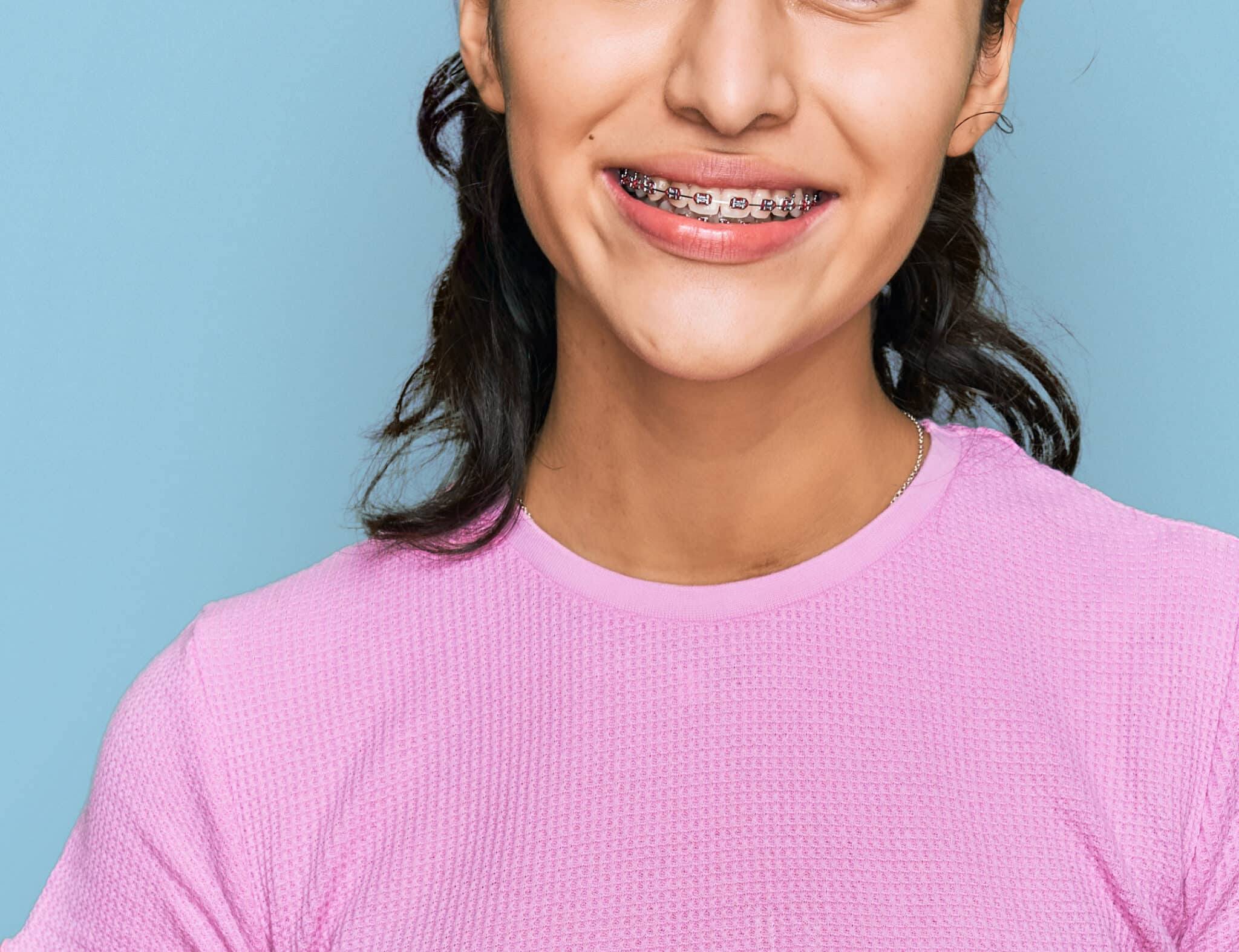 Braces 101: Everything You Need to Know to Get Started