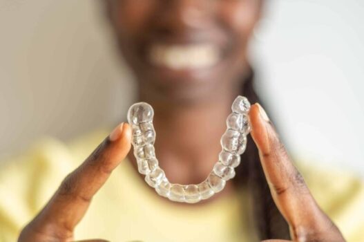 Invisalign With Implants: Is It Possible?